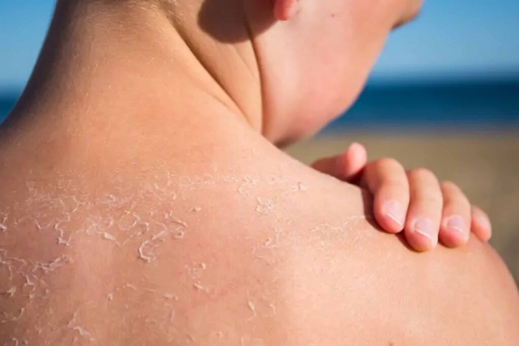Dead Skin