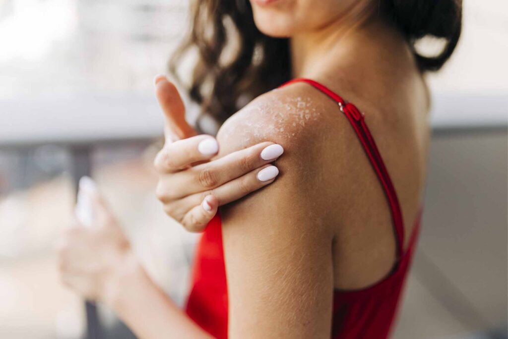 Damage Skin